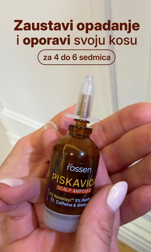 PISKAVICA-BANER-U-RUCI---MOB---BIH